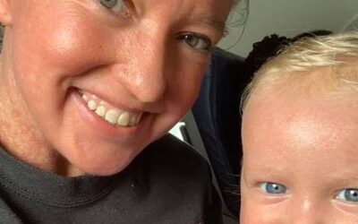Mamma e figlio di un anno cacciati dall’aereo per una malattia genetica della pelle